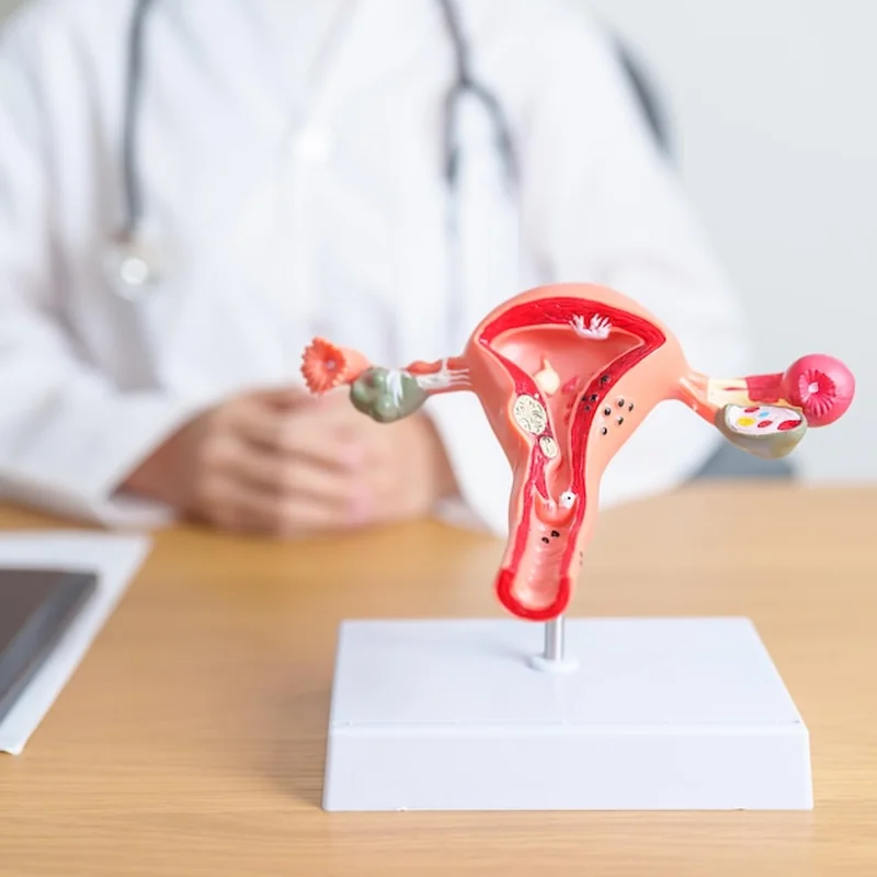 Jak leczyć zespół policystycznych jajników? Objawy i leczenie