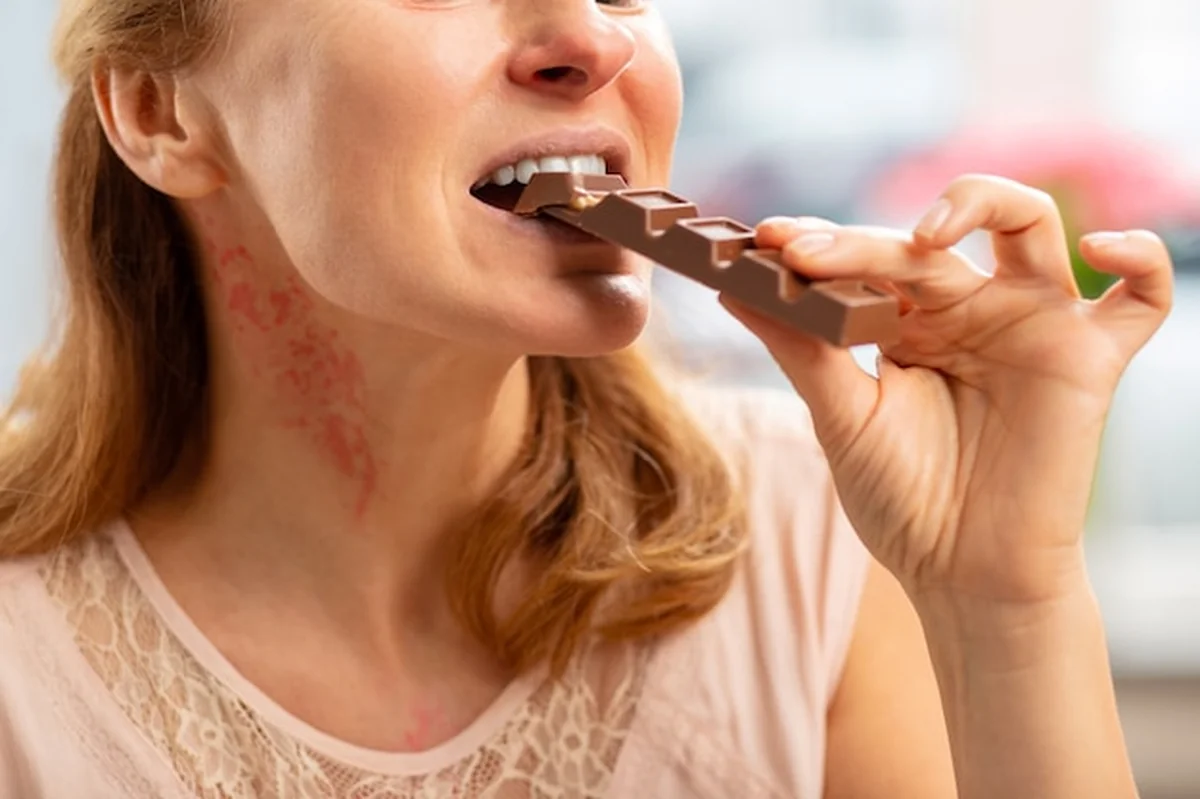 Blondwłosa kobieta z wysypką na szyi jedząca czekoladę