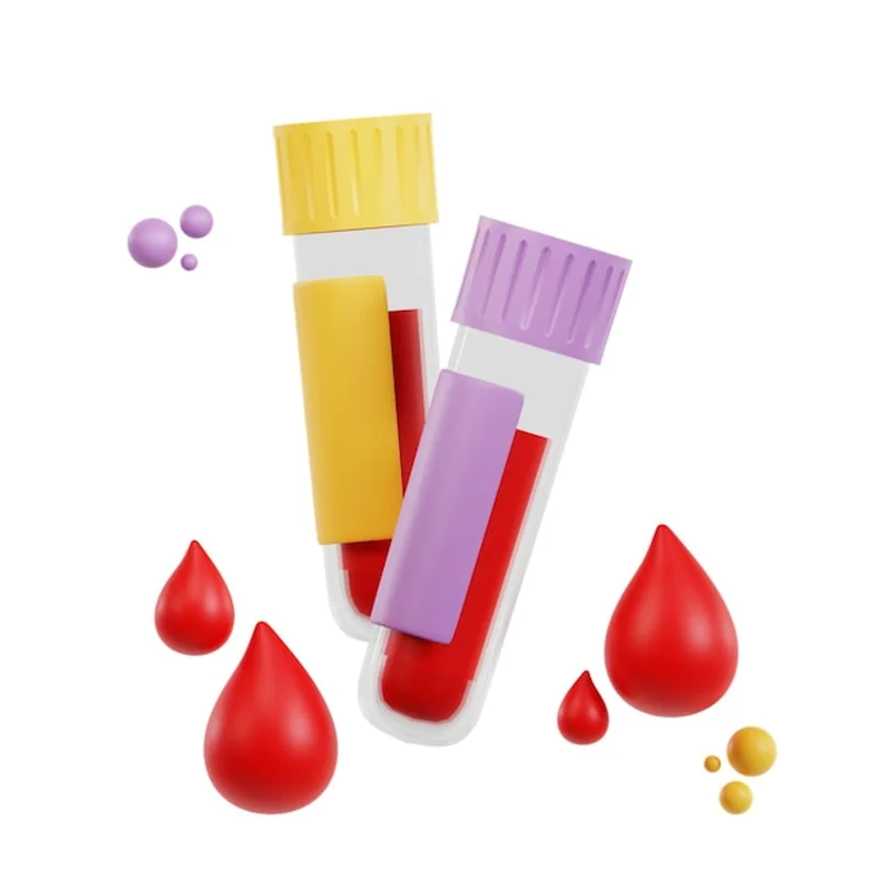 Pcos – jakie badania krwi wykonać? Sprawdź